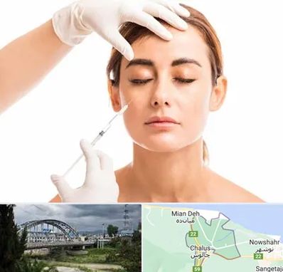 تزریق ژل گونه در چالوس