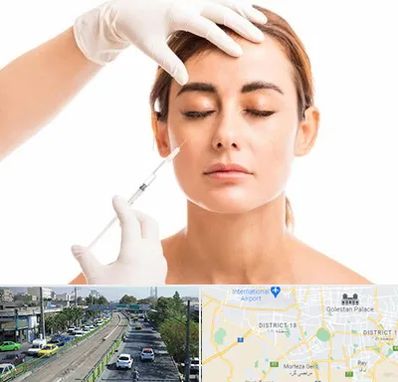 تزریق ژل گونه در جنوب تهران