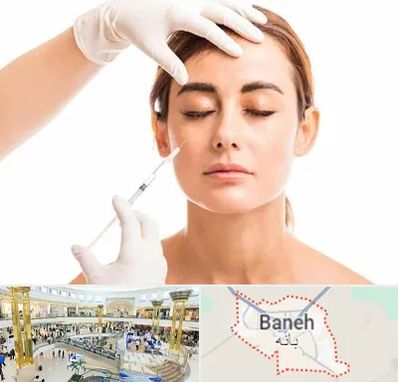 تزریق ژل گونه در بانه