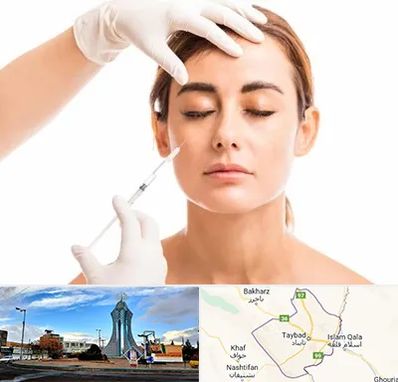 تزریق ژل گونه در تایباد