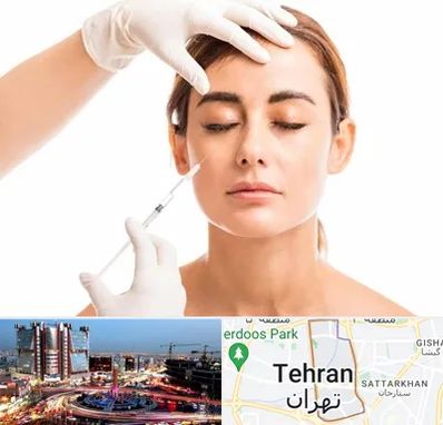تزریق ژل گونه در صادقیه تهران