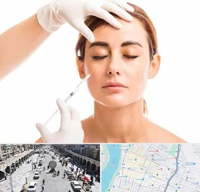 تزریق ژل گونه در نادری اهواز