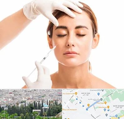 تزریق ژل گونه در محلاتی شیراز