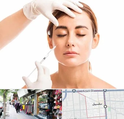تزریق ژل گونه در سلسبیل