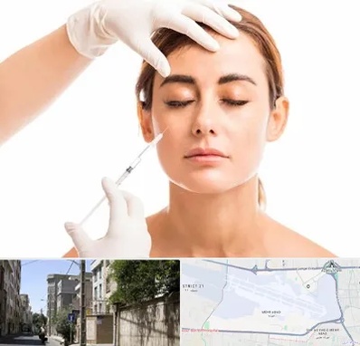تزریق ژل گونه در مهرآباد