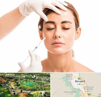 تزریق ژل گونه در بروجرد