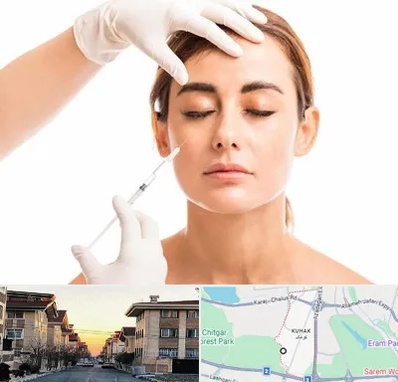 تزریق ژل گونه در کوهک