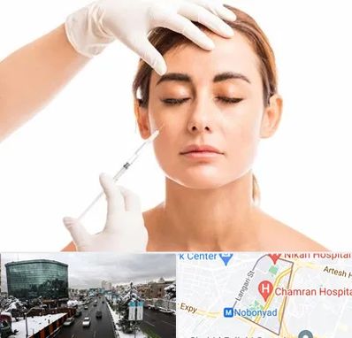 تزریق ژل گونه در اقدسیه