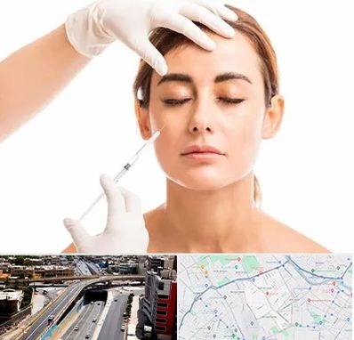 تزریق ژل گونه در ستارخان شیراز