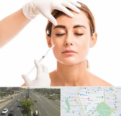 تزریق ژل گونه در منطقه 17 تهران