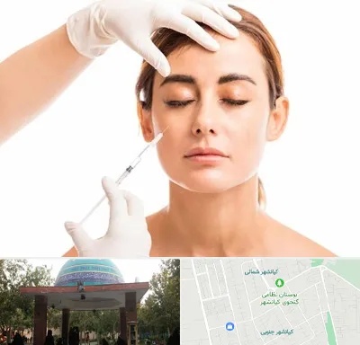 تزریق ژل گونه در کیانشهر