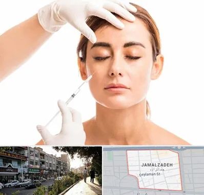 تزریق ژل گونه در خیابان جمالزاده