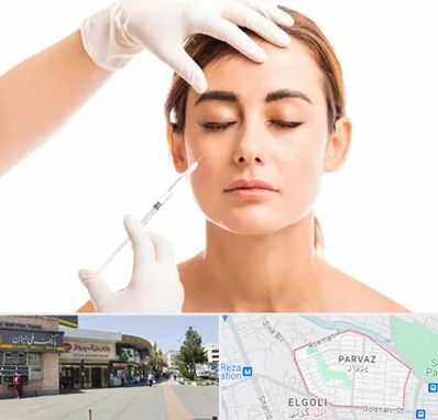 تزریق ژل گونه در پرواز تبریز