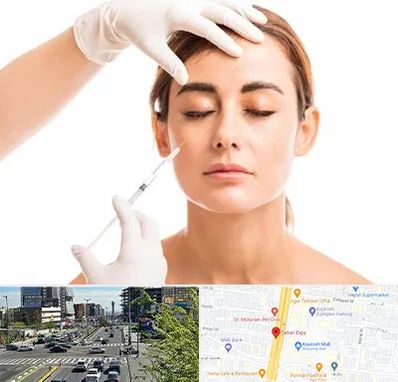 تزریق ژل گونه در ستاری