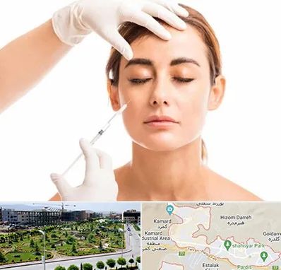 تزریق ژل گونه در پردیس