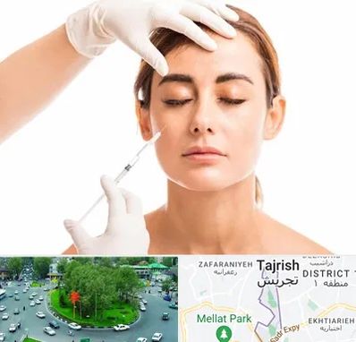 تزریق ژل گونه در تجریش