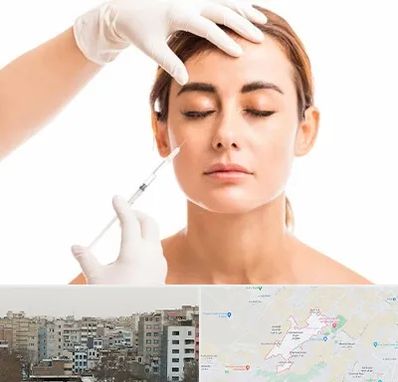 تزریق ژل گونه در محمد شهر کرج