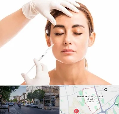 تزریق ژل گونه در شهرک ولیعصر