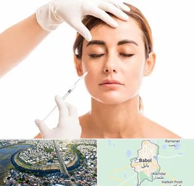 تزریق ژل گونه در بابل