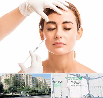 تزریق ژل گونه در آپادانا