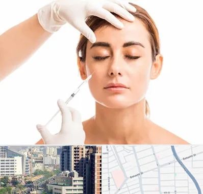 تزریق ژل گونه در خیابان بهشتی