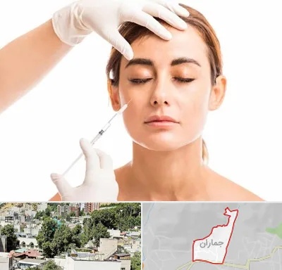 تزریق ژل گونه در جماران