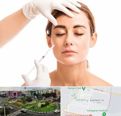 تزریق ژل گونه در تهرانسر