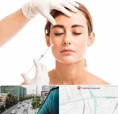 تزریق ژل گونه در بلوار فرحزادی