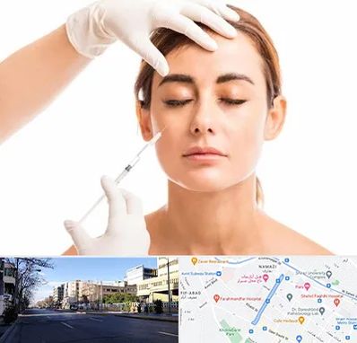 تزریق ژل گونه در خیابان ملاصدرا شیراز