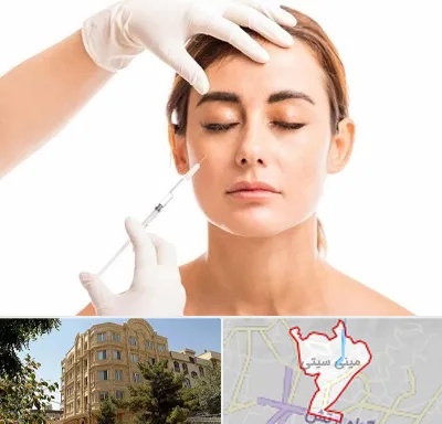 تزریق ژل گونه در مینی سیتی