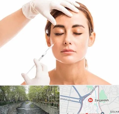 تزریق ژل گونه در زرگنده