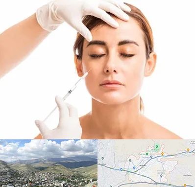 تزریق ژل گونه در رودهن