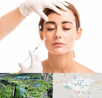 تزریق ژل گونه در بجنورد