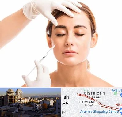 تزریق ژل گونه در فرمانیه