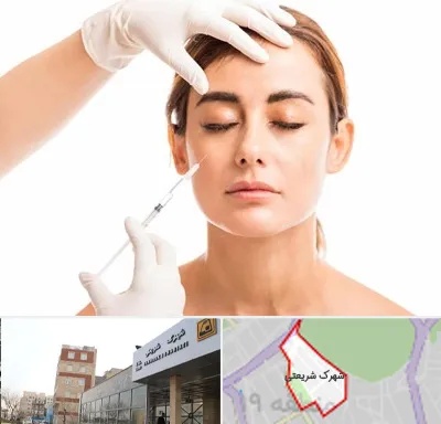 تزریق ژل گونه در شهرک شریعتی