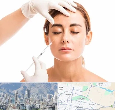 تزریق ژل گونه در شمال شرق تهران