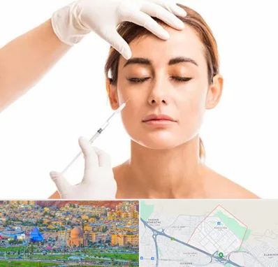 تزریق ژل گونه در رشدیه تبریز