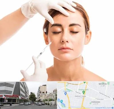 تزریق ژل گونه در بلوار فردوس