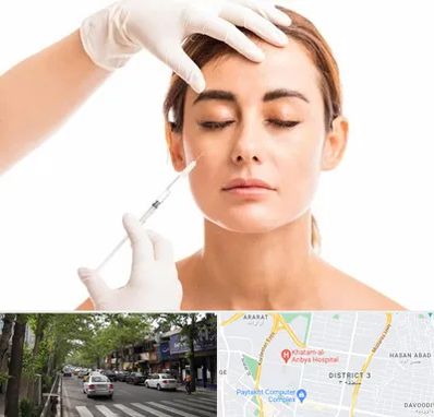 تزریق ژل گونه در ظفر