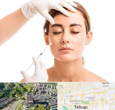 تزریق ژل گونه در شمال تهران