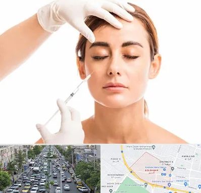 تزریق ژل گونه در گلشهر کرج