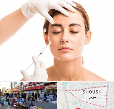 تزریق ژل گونه در شوش