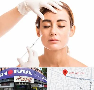 تزریق ژل گونه در امین حضور