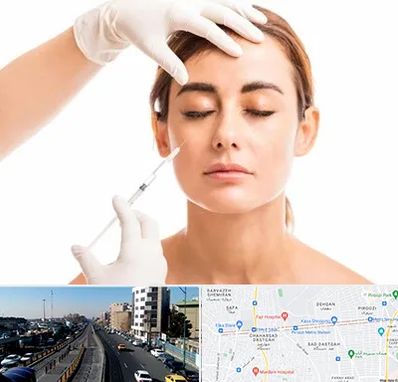 تزریق ژل گونه در پیروزی