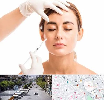 تزریق ژل گونه در خیابان زند شیراز