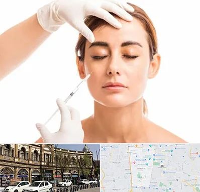 تزریق ژل گونه در منطقه 11 تهران