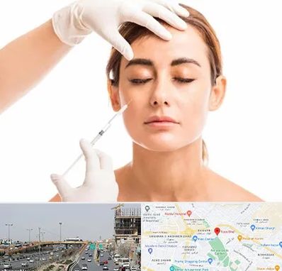 تزریق ژل گونه در بلوار توس مشهد