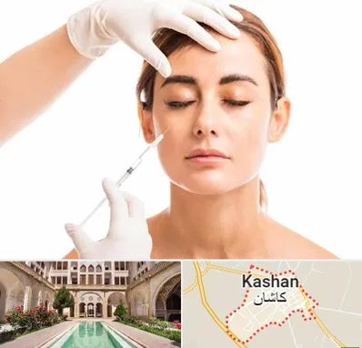 تزریق ژل گونه در کاشان