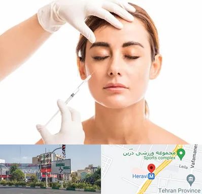 تزریق ژل گونه در هروی