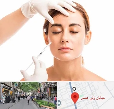 تزریق ژل گونه در ولیعصر شهریار